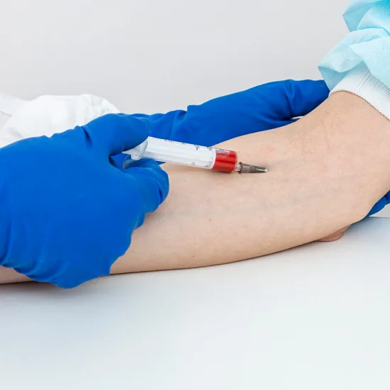 Measles (Rubeola) Antibody IgG